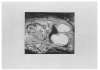 Image of Minor VI